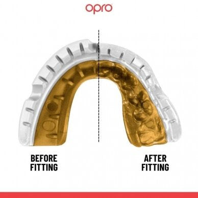 "OPRO" dantų apsauga turintiems breketus Self-Fit Gold Braces - Black/Gold