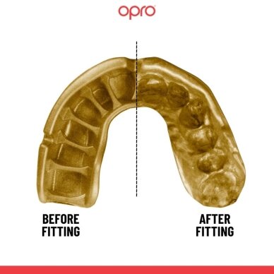 "OPRO" dantų apsauga Self-Fit UFC Gold - Black/Gold